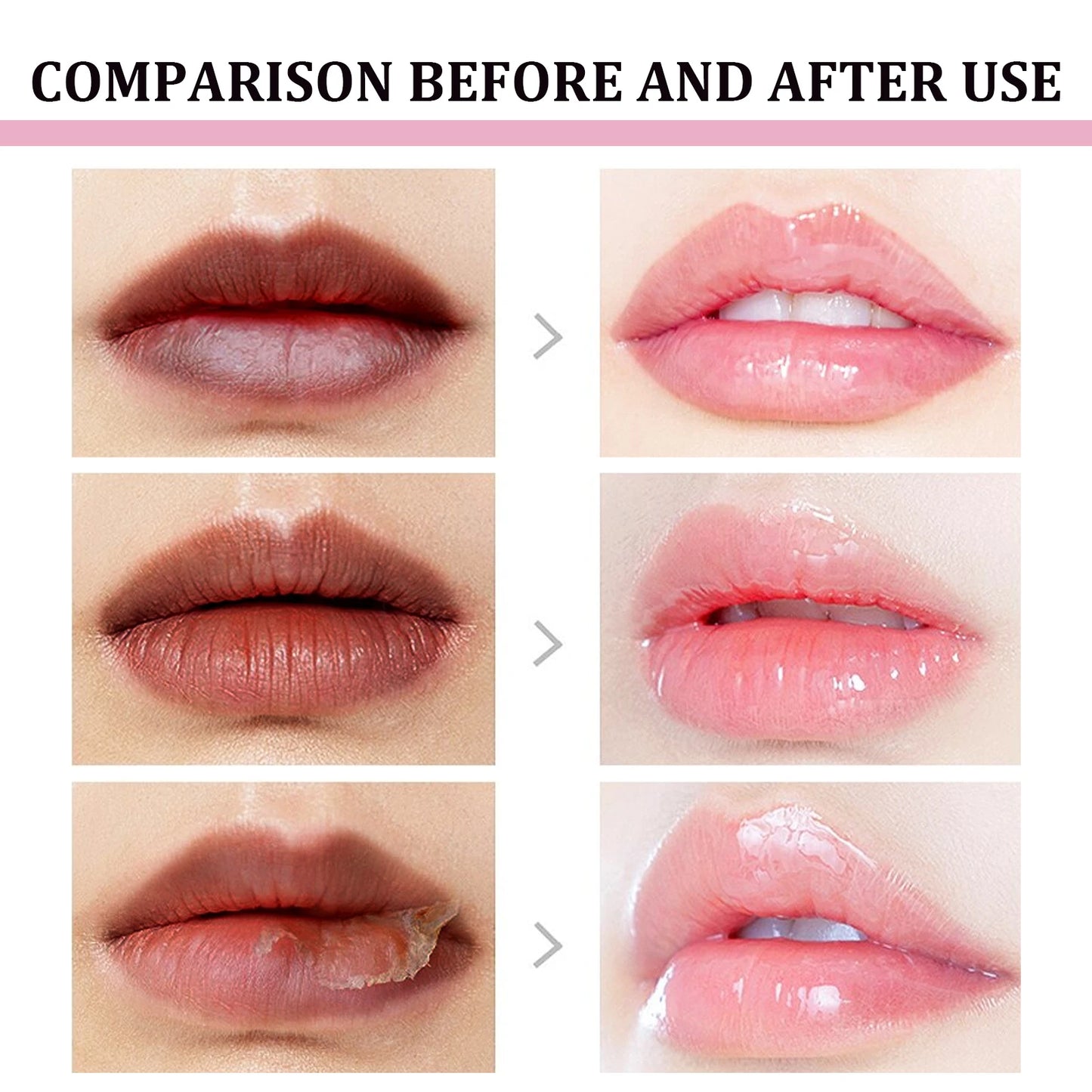Remove Dark Lip Balm Lighten Melanin Lip Mask Exfoliating Fade Lip Line Dead Skin Moisturizing Brighten Repair Lip Care