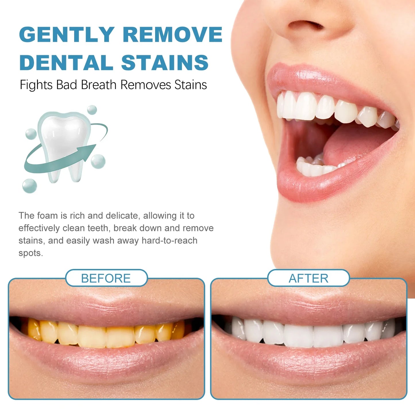 5 Pieces Tooth Brightening Mousse Toothpaste Fresh Breath Yellow Spot Removal Deep Cleaning Oral Hygiene Foam