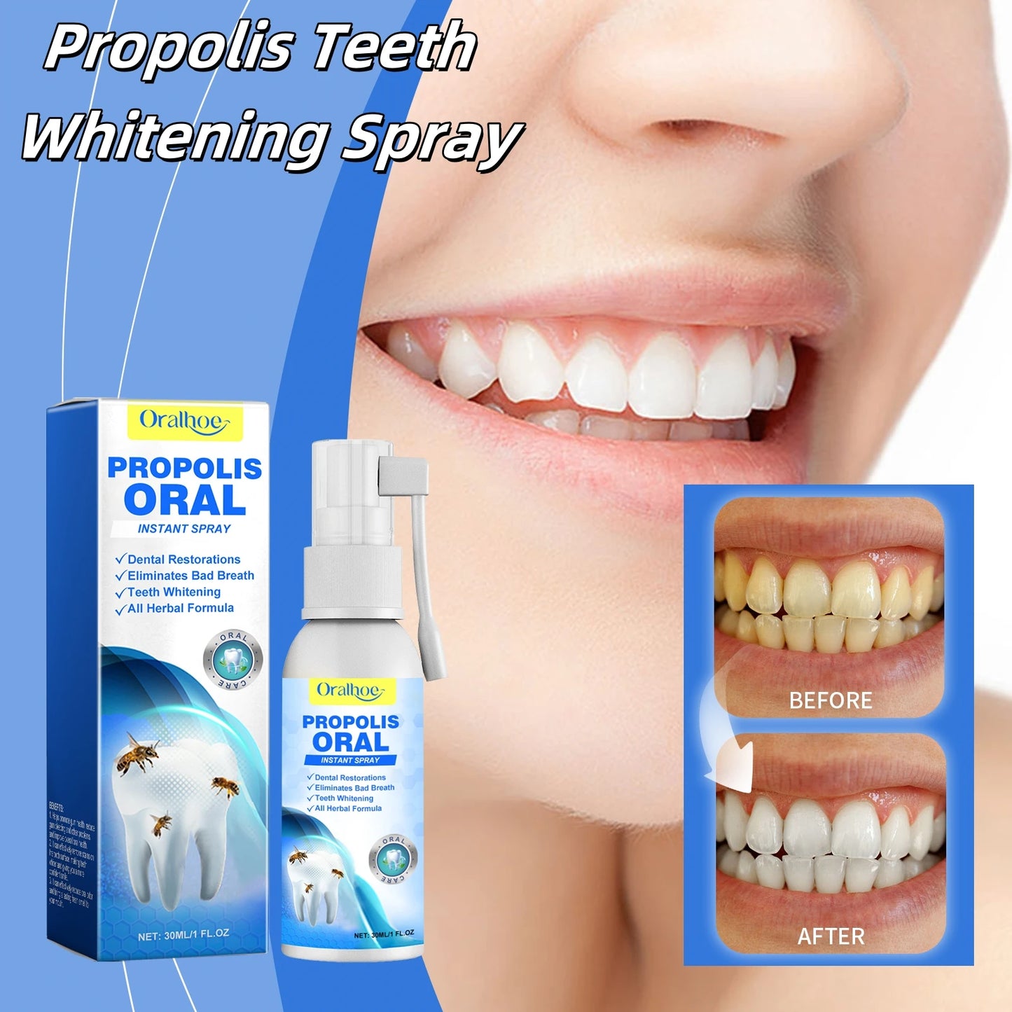 Teeth Whitening Spray to Improve Gum Health,Repair Tooth Whiten Teeth and Fresh Breath.Dry Mouth Treatment Oral Care Spray