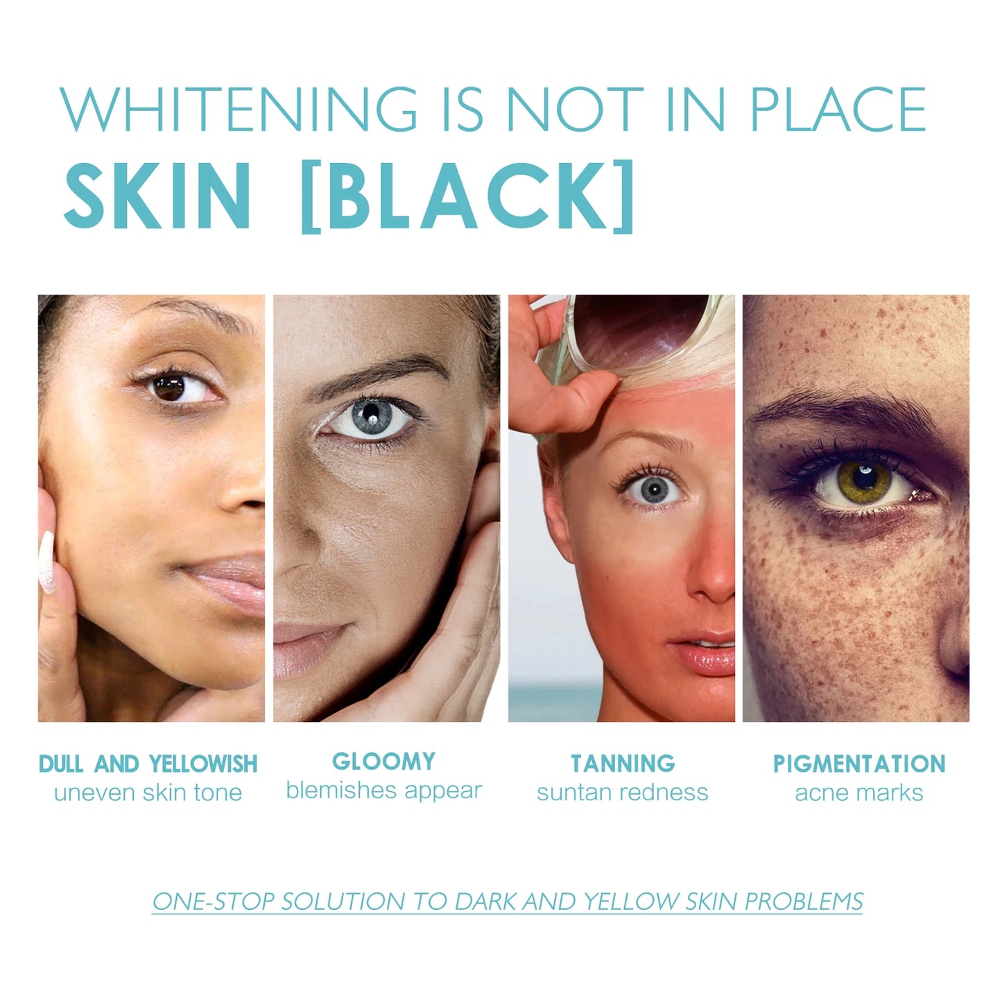 EELHOE Face Whitening Serum Melasma Essence Dark Spots Removal Brightening Skin Pigment Correction