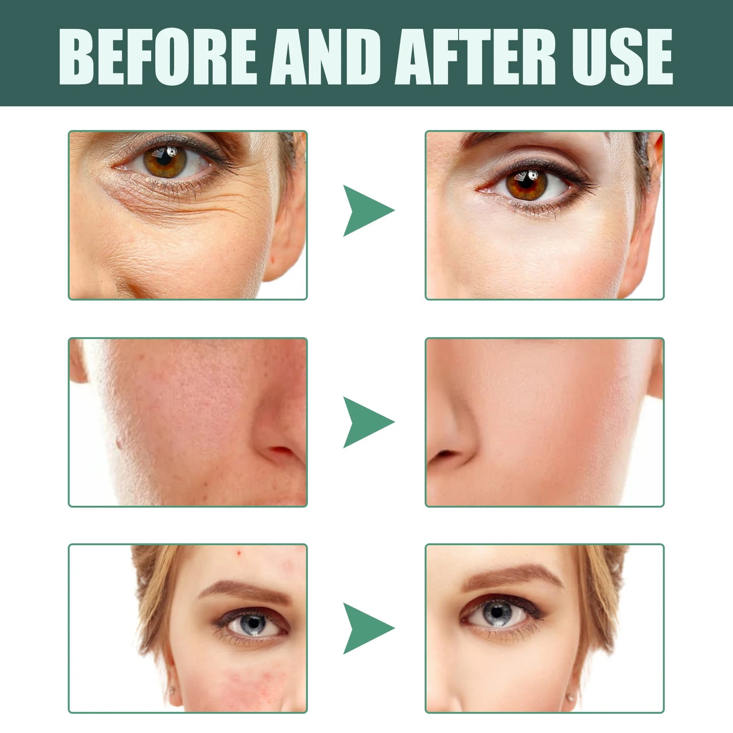 Retinol Face Essence Vitamin A Serum Reduces Fine Lines Shrinks Pores Brightens Moisturizes Tightens Skin Facial Care