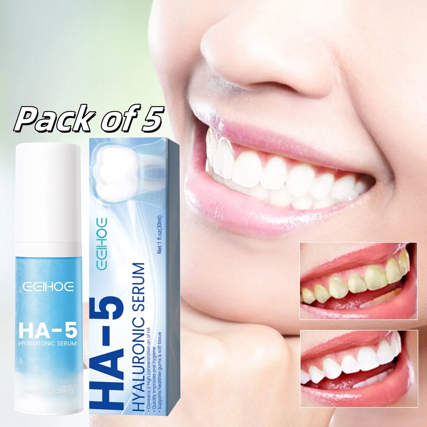 5pcs Teeth Brightening Toothpaste Quickly Removes Cigarette, Coffee and Tea Stains Cleans Oral Hygiene Manages Fresh Breath