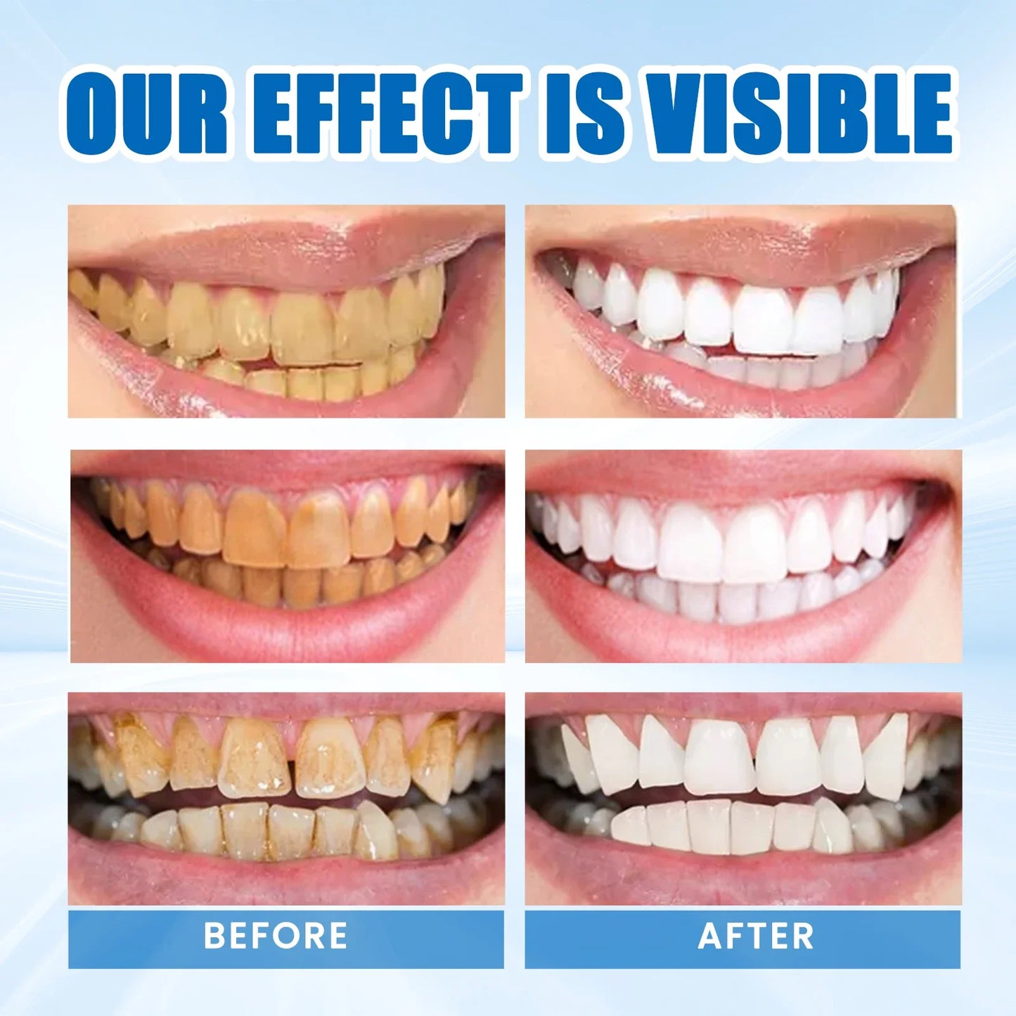 5pcs Teeth Brightening Toothpaste Quickly Removes Cigarette, Coffee and Tea Stains Cleans Oral Hygiene Manages Fresh Breath